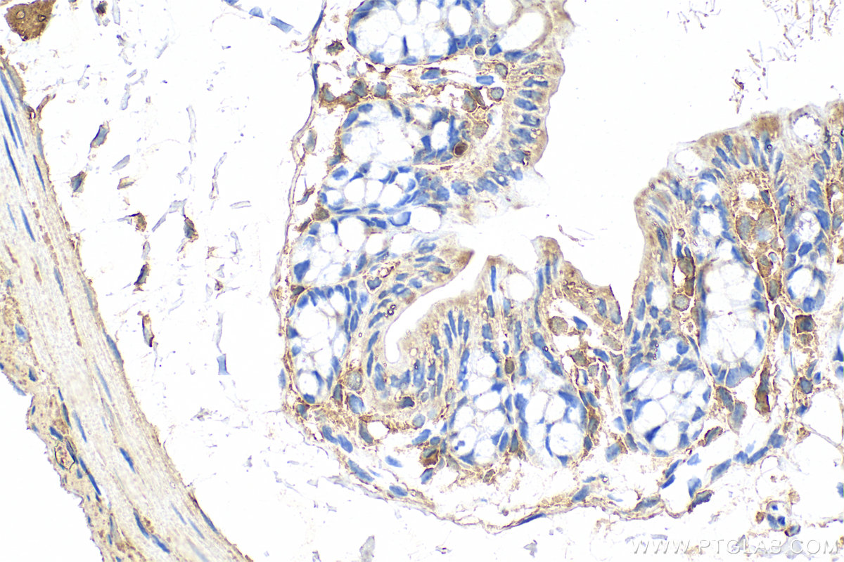 IHC staining of mouse colon using 11858-1-AP