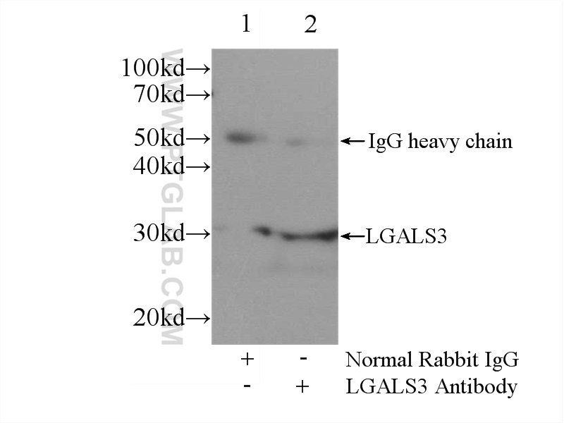 IP experiment of MCF-7 using 14979-1-AP