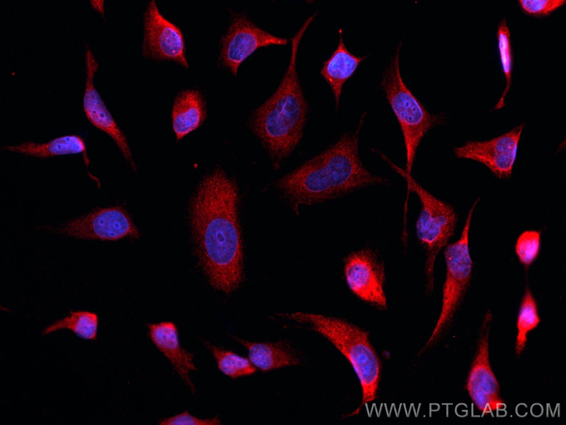 IF Staining of HeLa using 60207-1-Ig