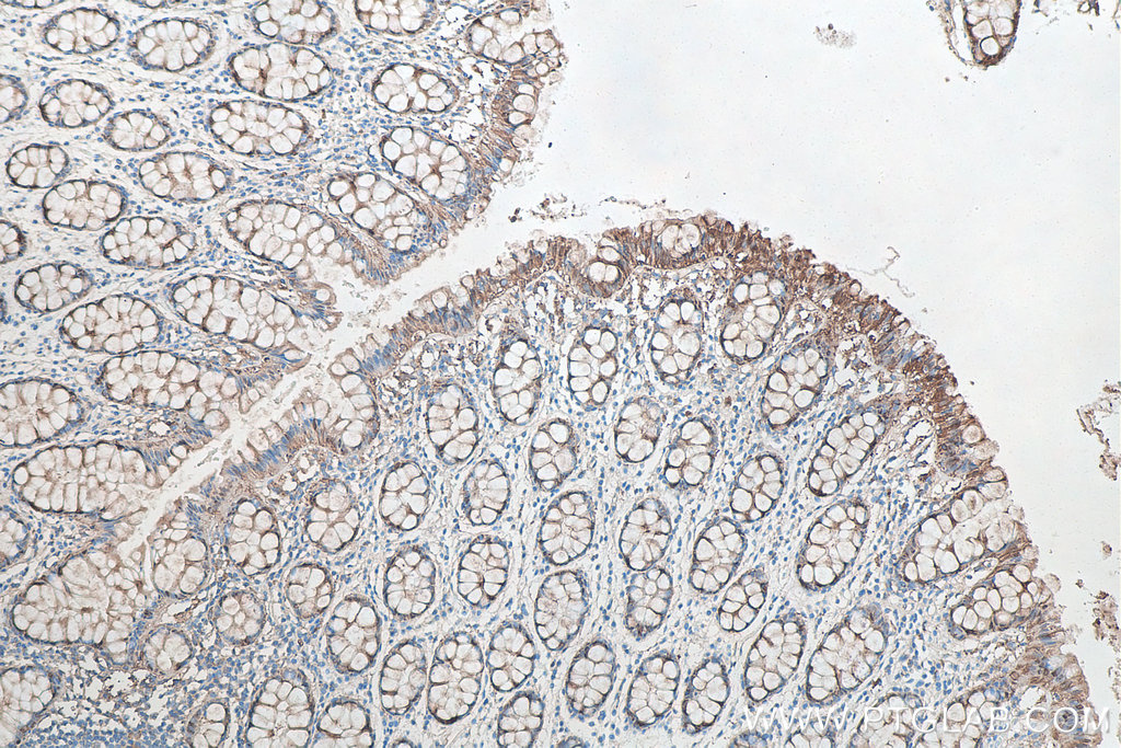 IHC staining of human colon using 60207-1-Ig IHC staining of human colon using 60207-1-Ig
