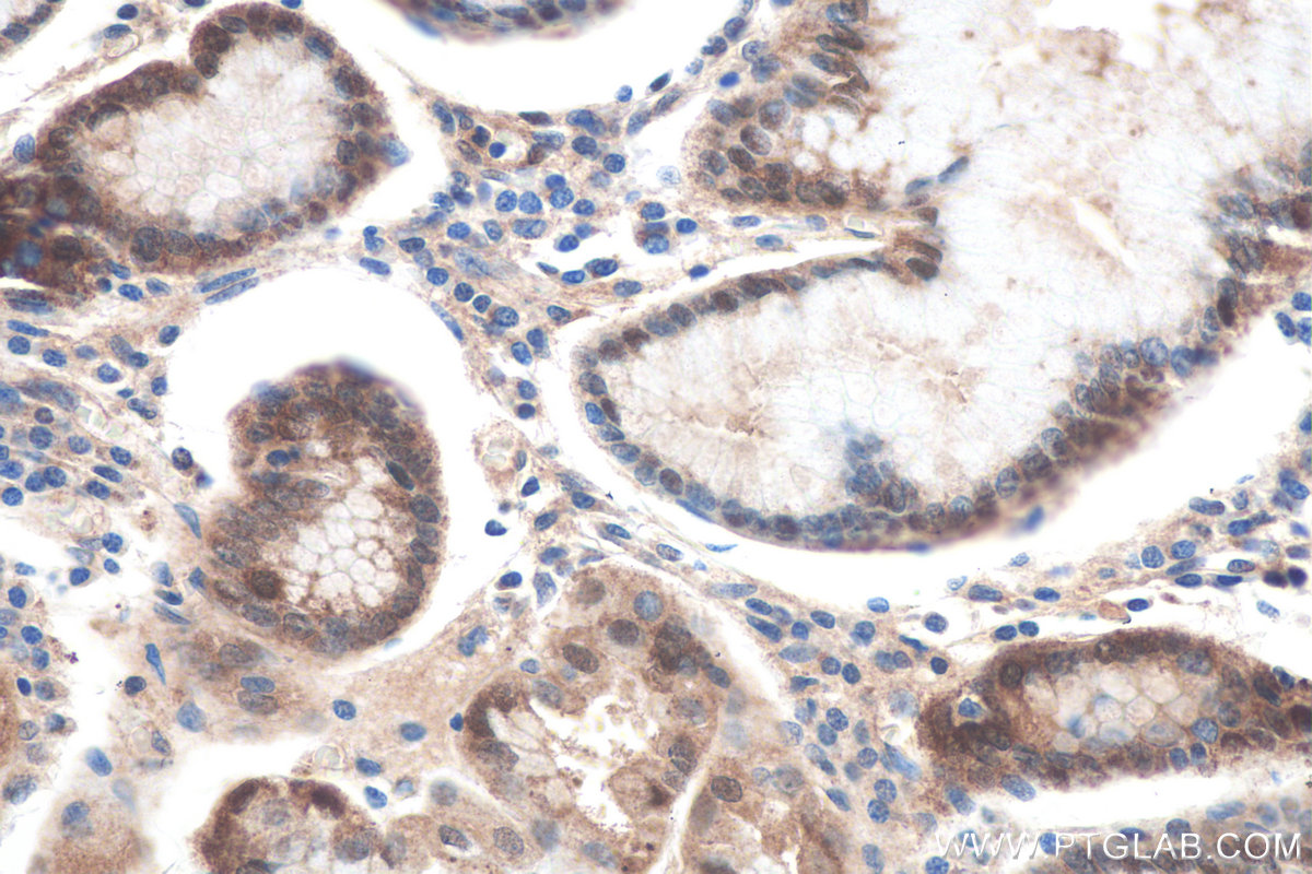 IHC staining of human stomach using 60207-1-Ig IHC staining of human stomach using 60207-1-Ig