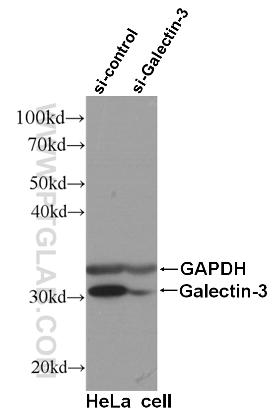 WB analysis of HeLa cells using 60207-1-Ig