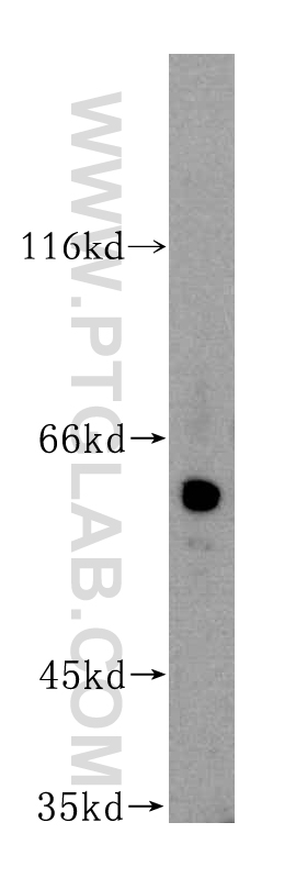WB analysis of human placenta using 16240-1-AP (same clone as 16240-1-PBS)