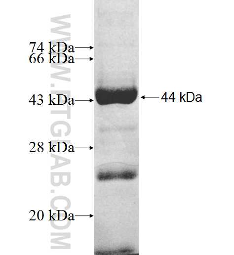 GAL3ST4 fusion protein Ag9063 SDS-PAGE