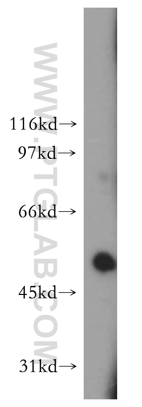 WB analysis of A375 using 12887-1-AP