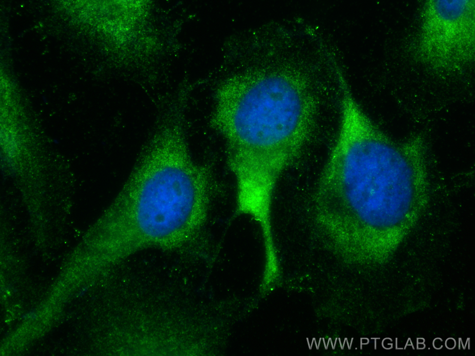 IF Staining of HeLa using 14414-1-AP