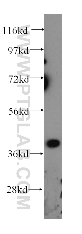 WB analysis of A375 using 14414-1-AP