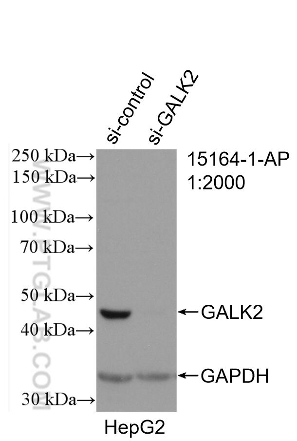 WB analysis of HepG2 using 15164-1-AP