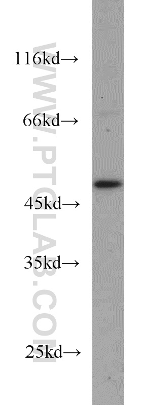 WB analysis of HL-60 using 15164-1-AP