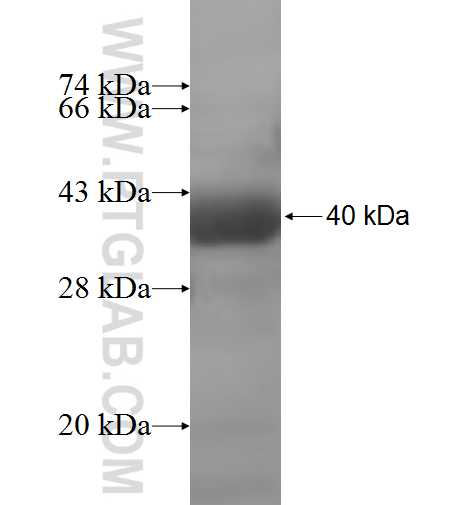 GALK2 fusion protein Ag7295 SDS-PAGE GALK2 fusion protein Ag7295 SDS-PAGE
