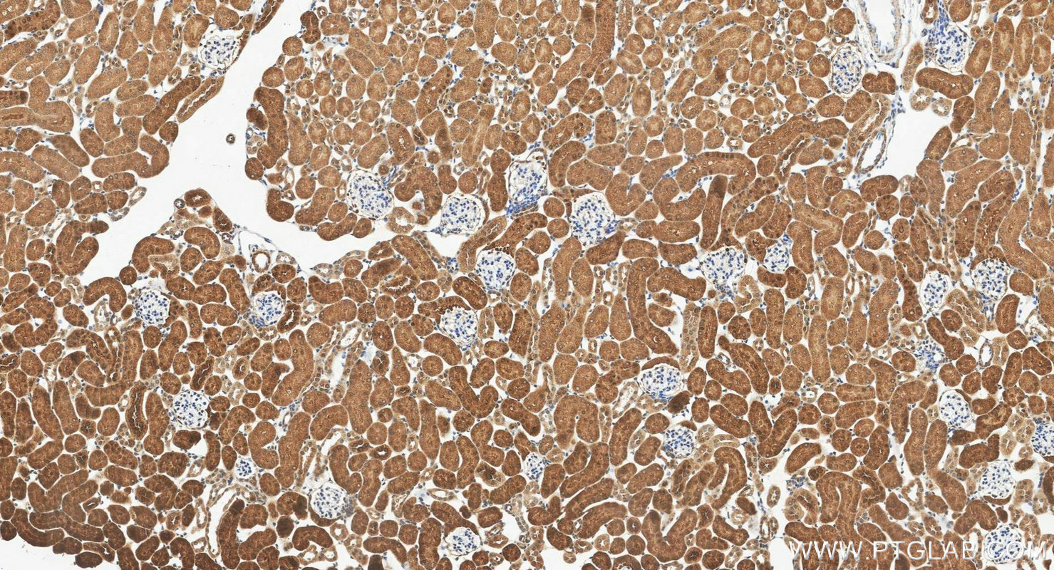 IHC staining of mouse kidney using 16022-1-AP
