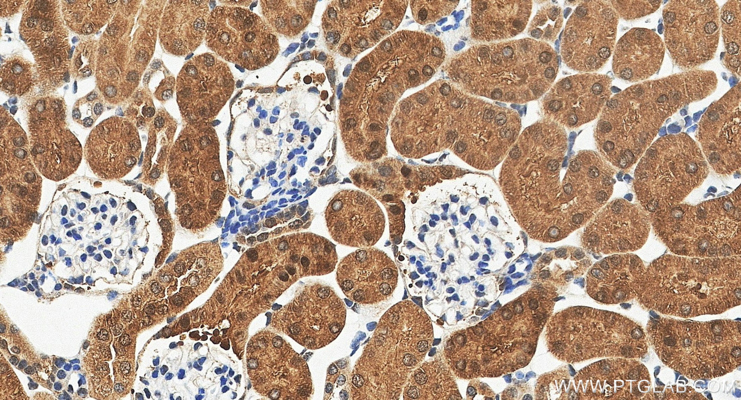 IHC staining of mouse kidney using 16022-1-AP