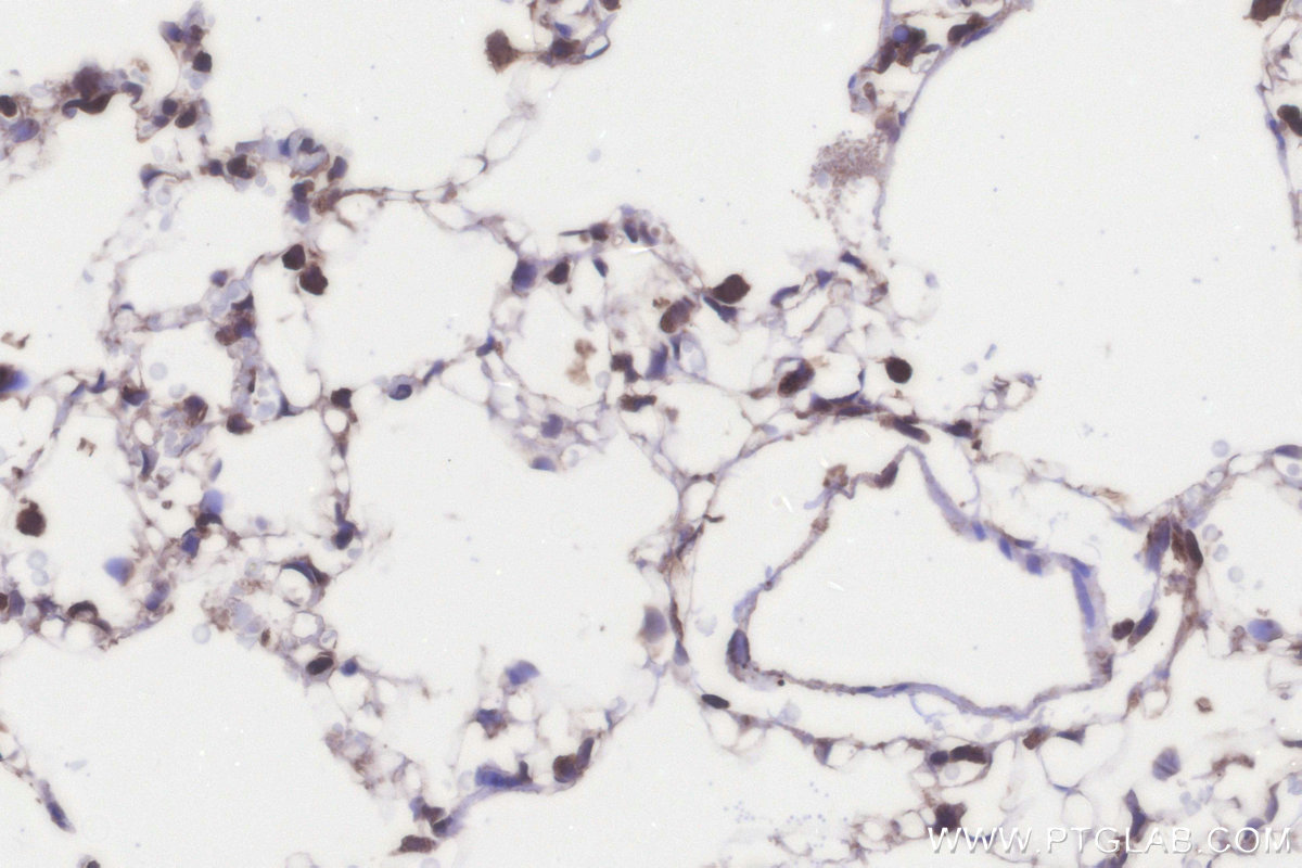 IHC staining of rat lung using 21139-1-AP (same clone as 21139-1-PBS) IHC staining of rat lung using 21139-1-AP (same clone as 21139-1-PBS)
