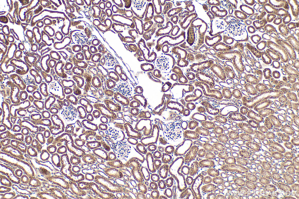 IHC staining of mouse kidney using 21139-1-AP (same clone as 21139-1-PBS) IHC staining of mouse kidney using 21139-1-AP (same clone as 21139-1-PBS)