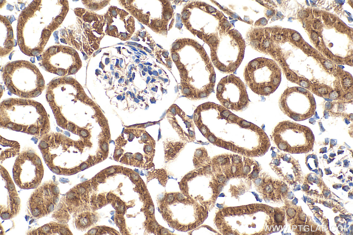 IHC staining of mouse kidney using 21139-1-AP (same clone as 21139-1-PBS) IHC staining of mouse kidney using 21139-1-AP (same clone as 21139-1-PBS)