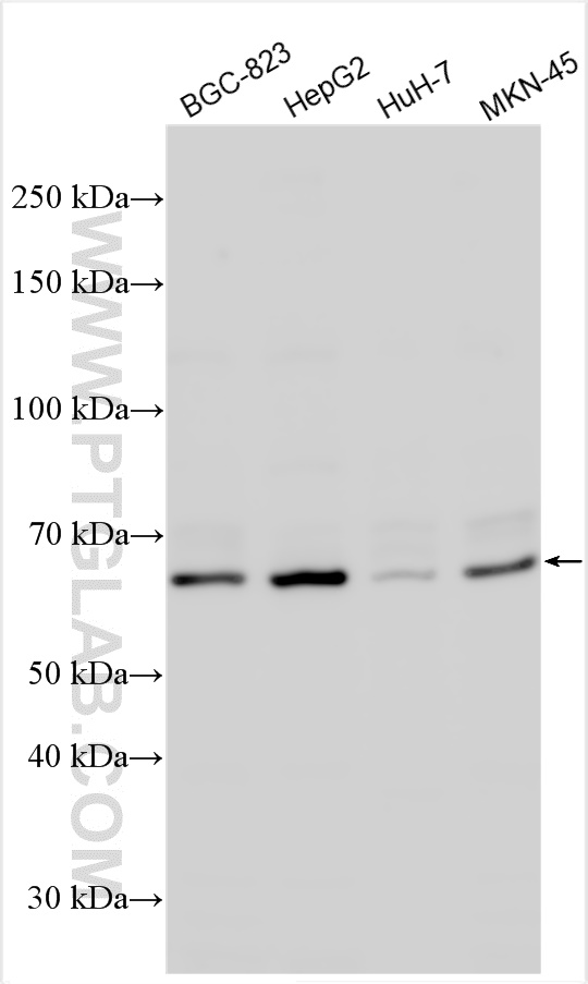 WB analysis using 21139-1-AP
