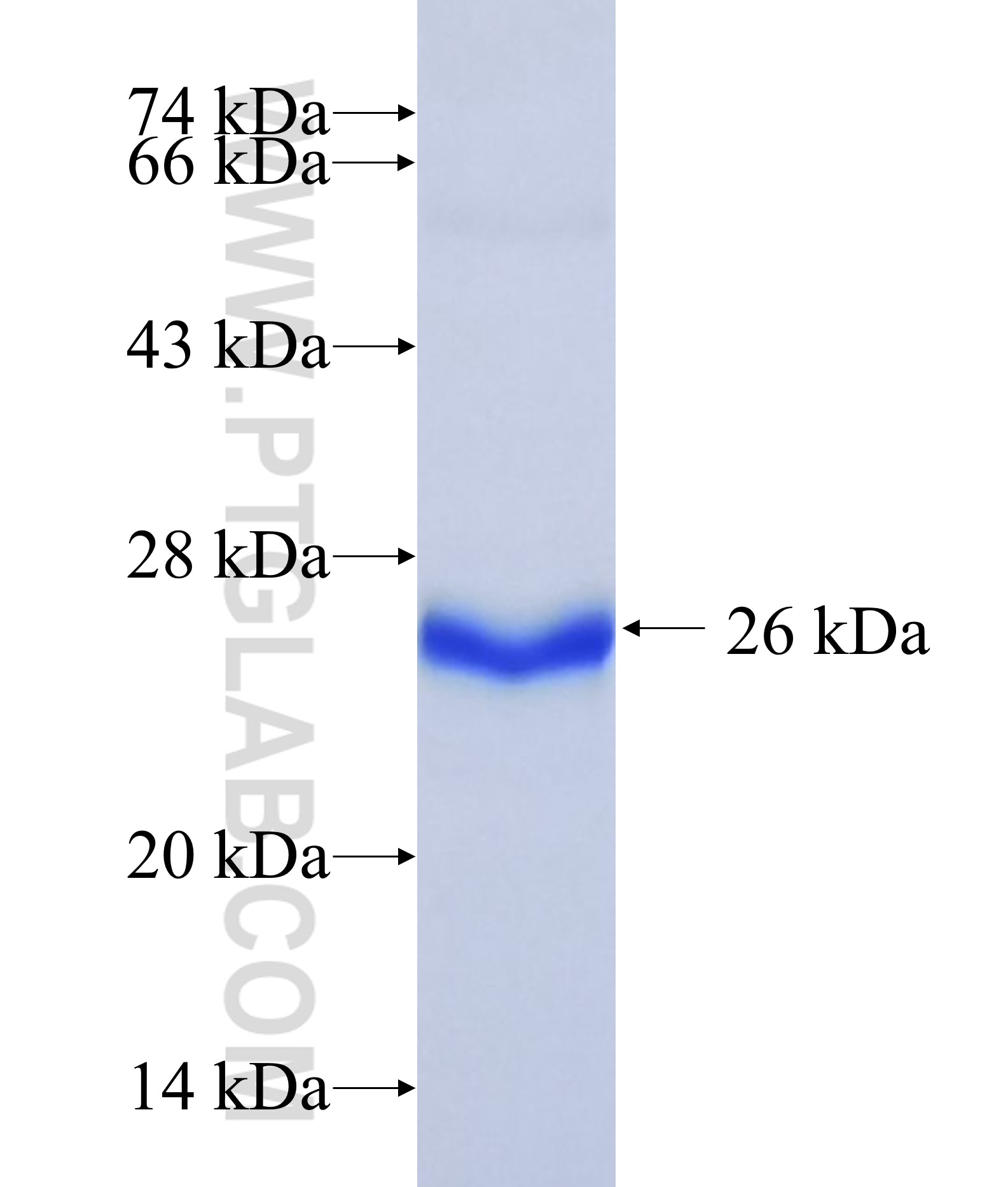 GALNT1 fusion protein Ag15771 SDS-PAGE GALNT1 fusion protein Ag15771 SDS-PAGE
