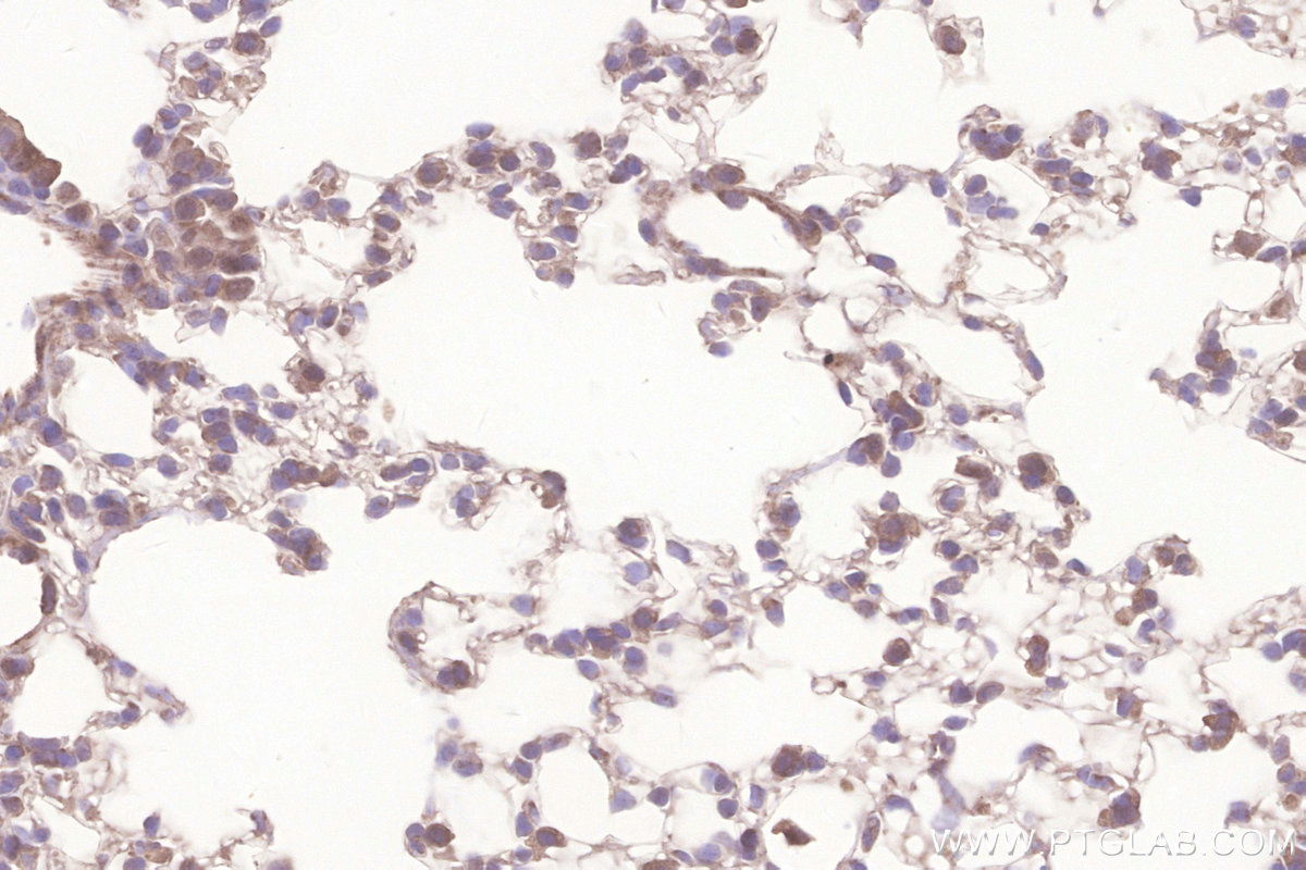 IHC staining of mouse lung using 20822-1-AP IHC staining of mouse lung using 20822-1-AP