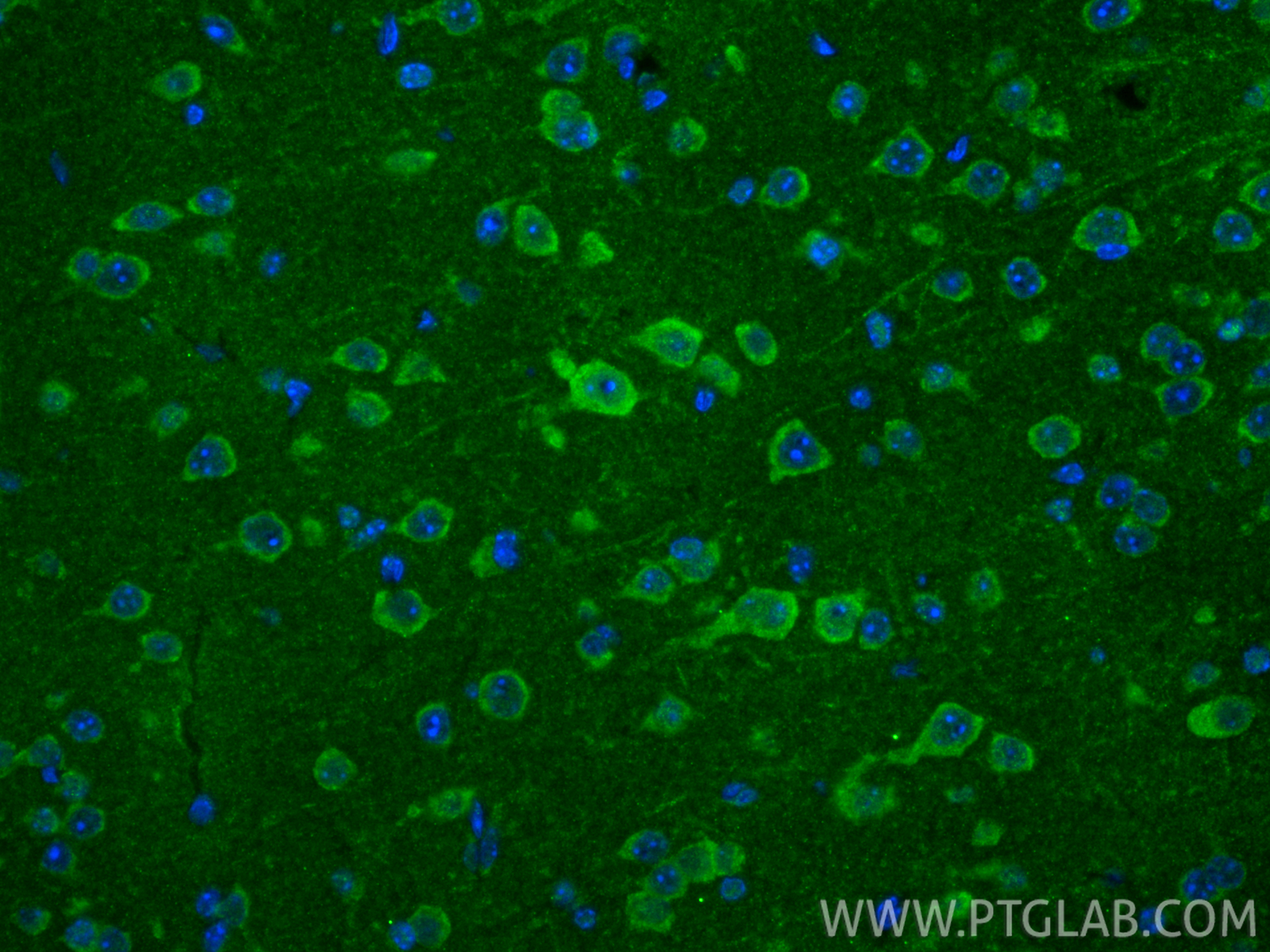 IF Staining of mouse brain using 24604-1-AP (same clone as 24604-1-PBS)