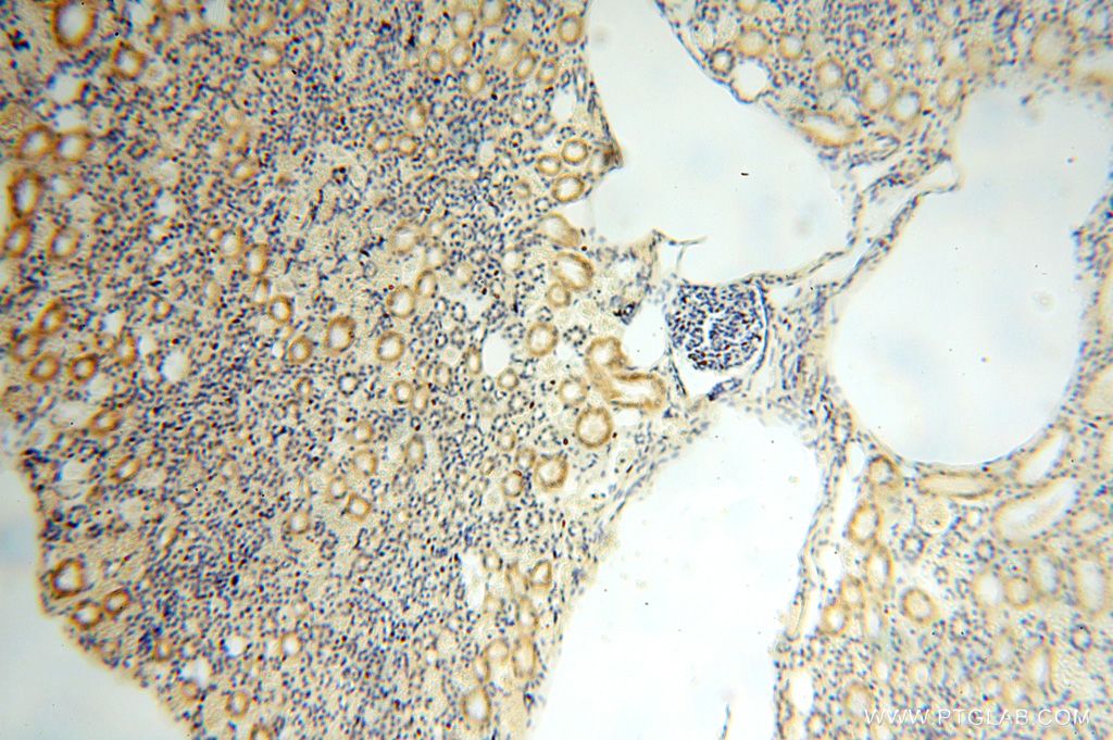 IHC staining of human kidney using 16939-1-AP