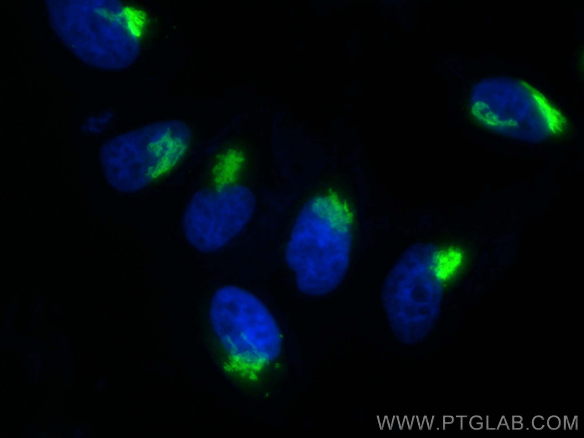 IF Staining of HeLa using 17441-1-AP