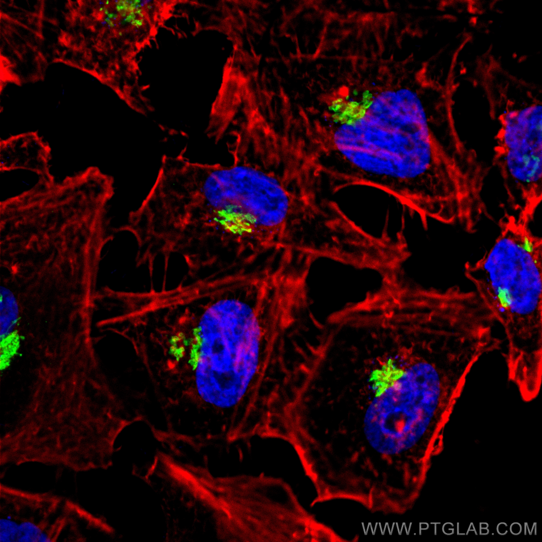 IF Staining of HeLa using 17441-1-AP