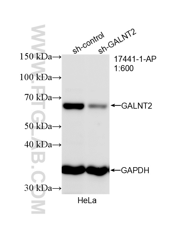 WB analysis of HeLa using 17441-1-AP
