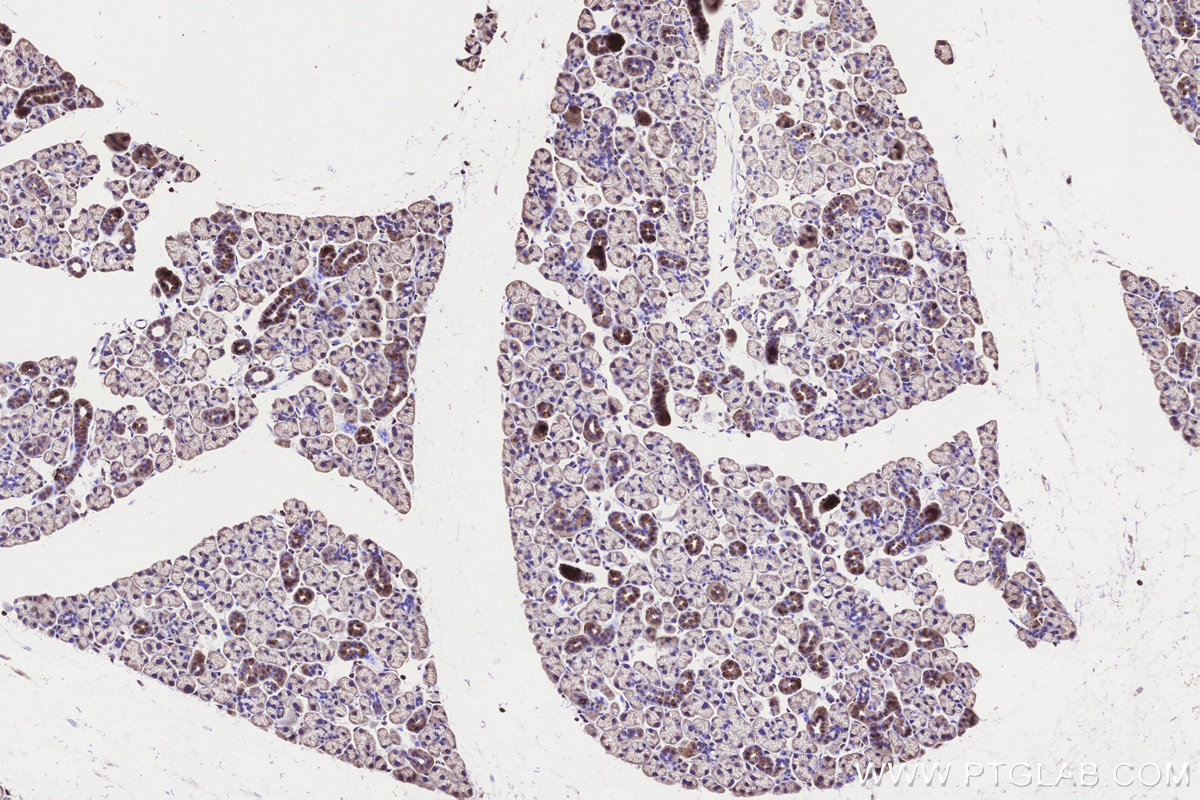 IHC staining of mouse salivary gland using 13671-1-AP IHC staining of mouse salivary gland using 13671-1-AP
