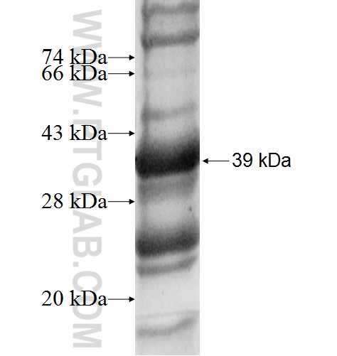 GALNT6 fusion protein Ag6949 SDS-PAGE GALNT6 fusion protein Ag6949 SDS-PAGE