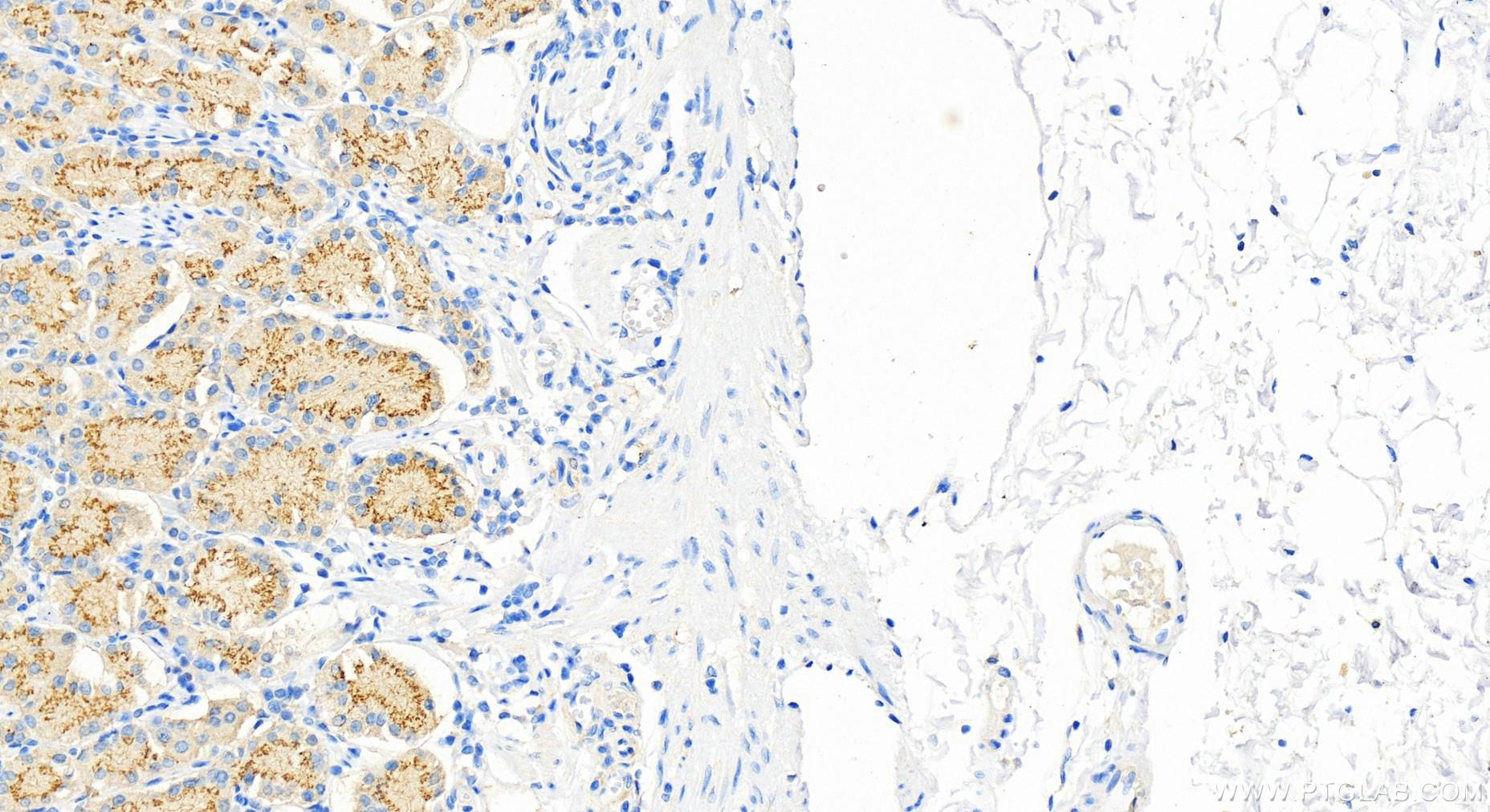 Immunohistochemical analysis of paraffin-embedded human stomach tissue slide using 13962-1-AP (GALNT7 antibody) at dilution of 1:300 (under 20x lens). Heat mediated antigen retrieval with Tris-EDTA buffer (pH 9.0). IHC staining of human stomach using 13962-1-AP
