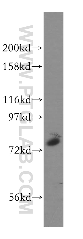 WB analysis of HeLa using 13962-1-AP