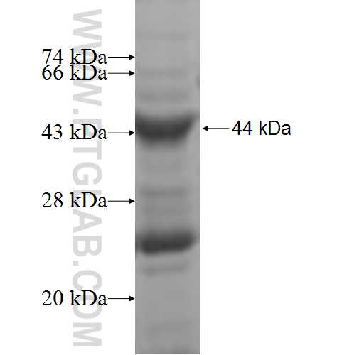 GALNT7 fusion protein Ag4936 SDS-PAGE GALNT7 fusion protein Ag4936 SDS-PAGE