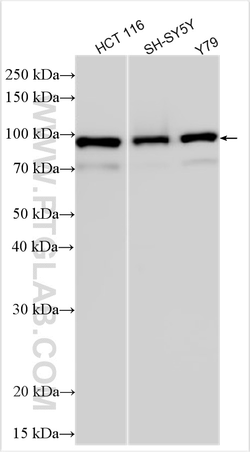 WB analysis using 24025-1-AP