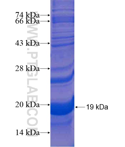 GALNT8 fusion protein Ag21185 SDS-PAGE