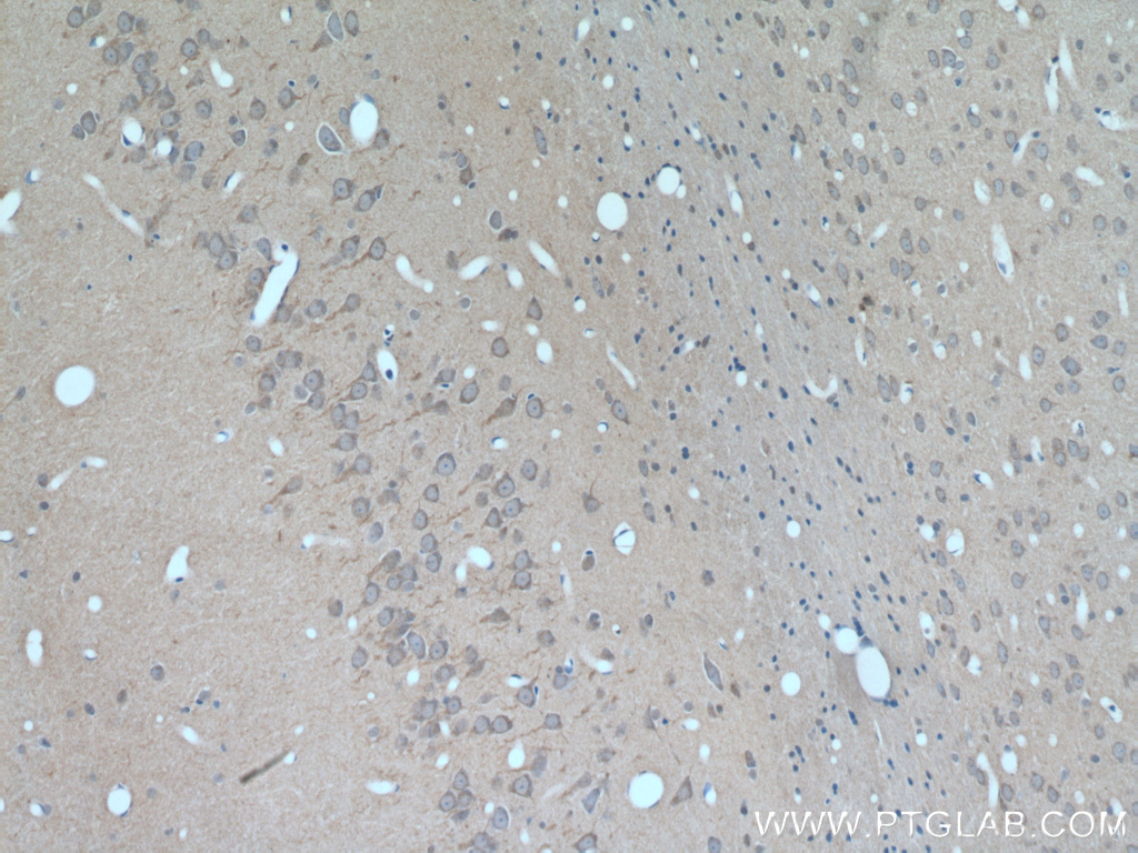 IHC staining of rat brain using 25967-1-AP