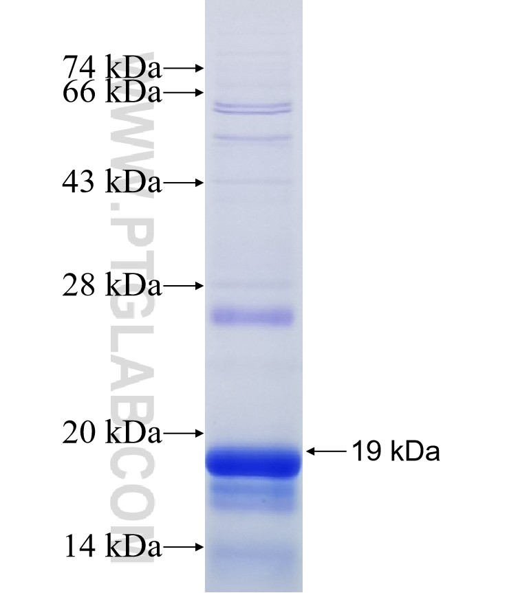 GALNTL1 fusion protein Ag15776 SDS-PAGE