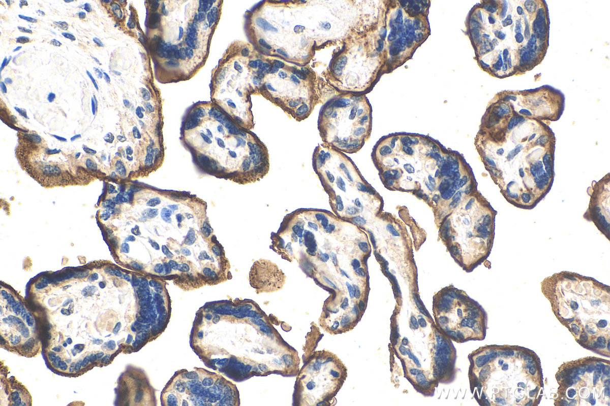 IHC staining of human placenta using 16900-1-AP