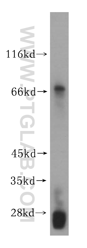 WB analysis of HEK-293 using 16900-1-AP