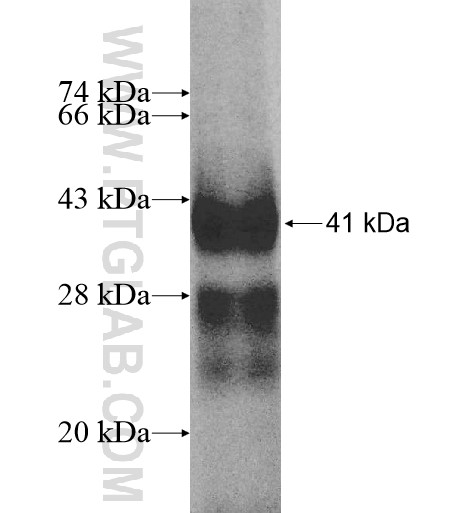 GALNTL2 fusion protein Ag10455 SDS-PAGE GALNTL2 fusion protein Ag10455 SDS-PAGE