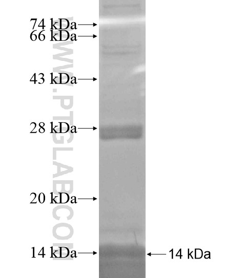 GALP fusion protein Ag19581 SDS-PAGE GALP fusion protein Ag19581 SDS-PAGE