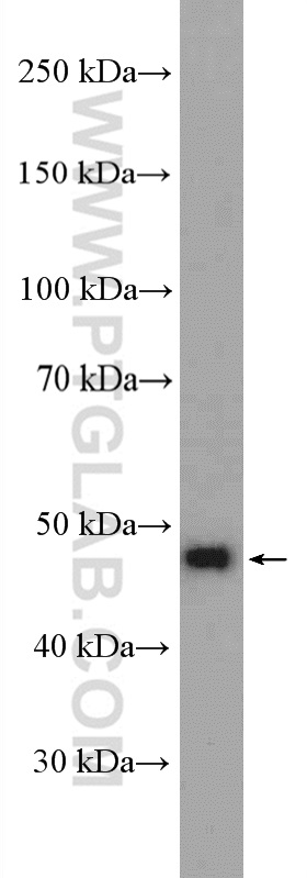 WB analysis of SH-SY5Y using 26459-1-AP