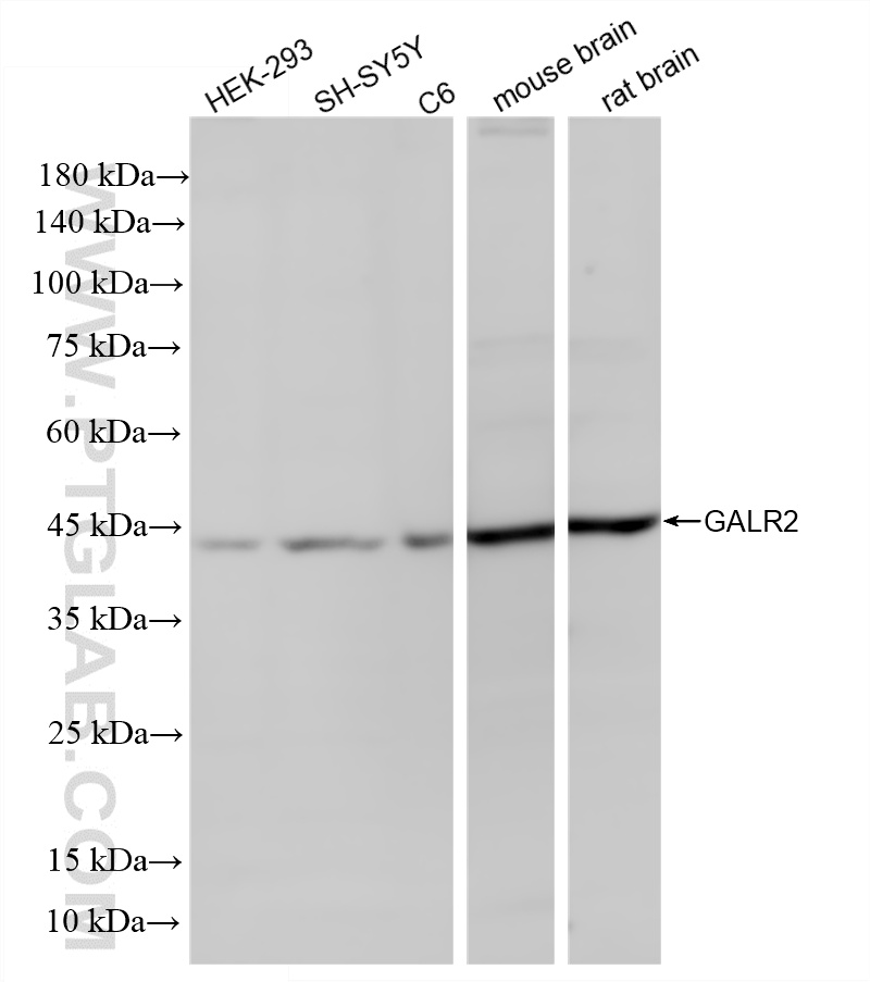 Various lysates were subjected to SDS PAGE followed by western blot with 87015-1-RR (GALR2 antibody) at dilution of 1:2000 incubated at room temperature for 1.5 hours. WB analysis using 87015-1-RR