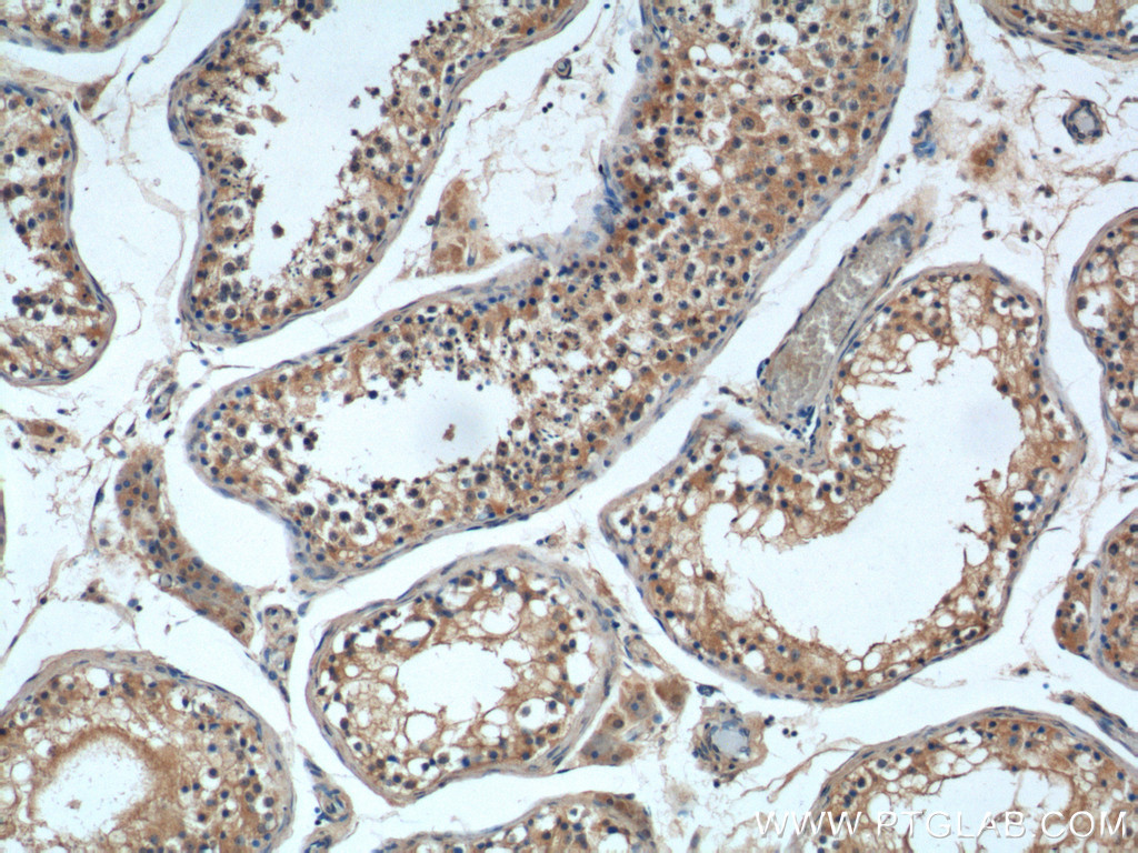 IHC staining of human testis using 20009-1-AP