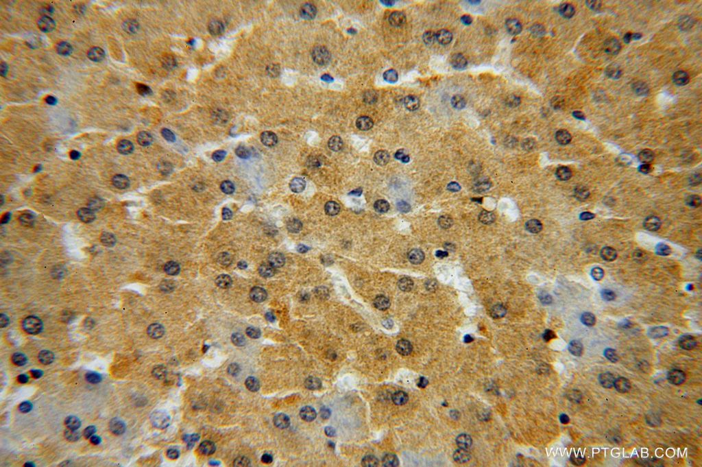 IHC staining of human liver using 17035-1-AP