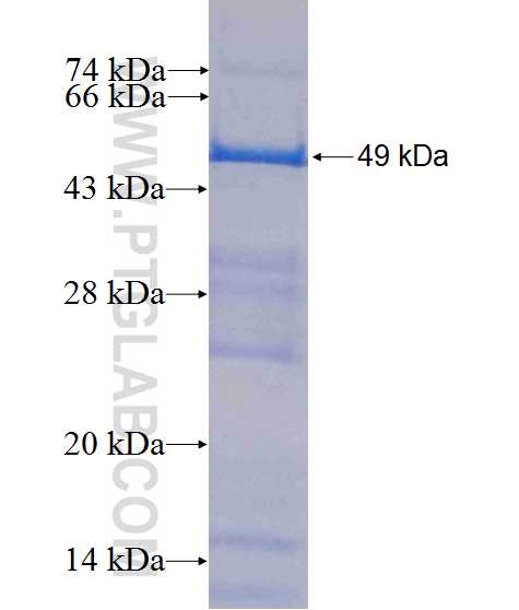 GALT fusion protein Ag10488 SDS-PAGE GALT fusion protein Ag10488 SDS-PAGE