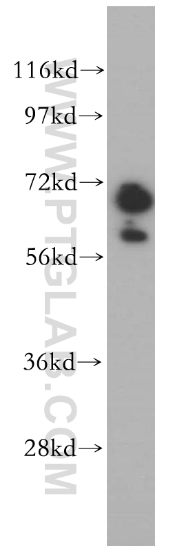 WB analysis of mouse brain using 14305-1-AP