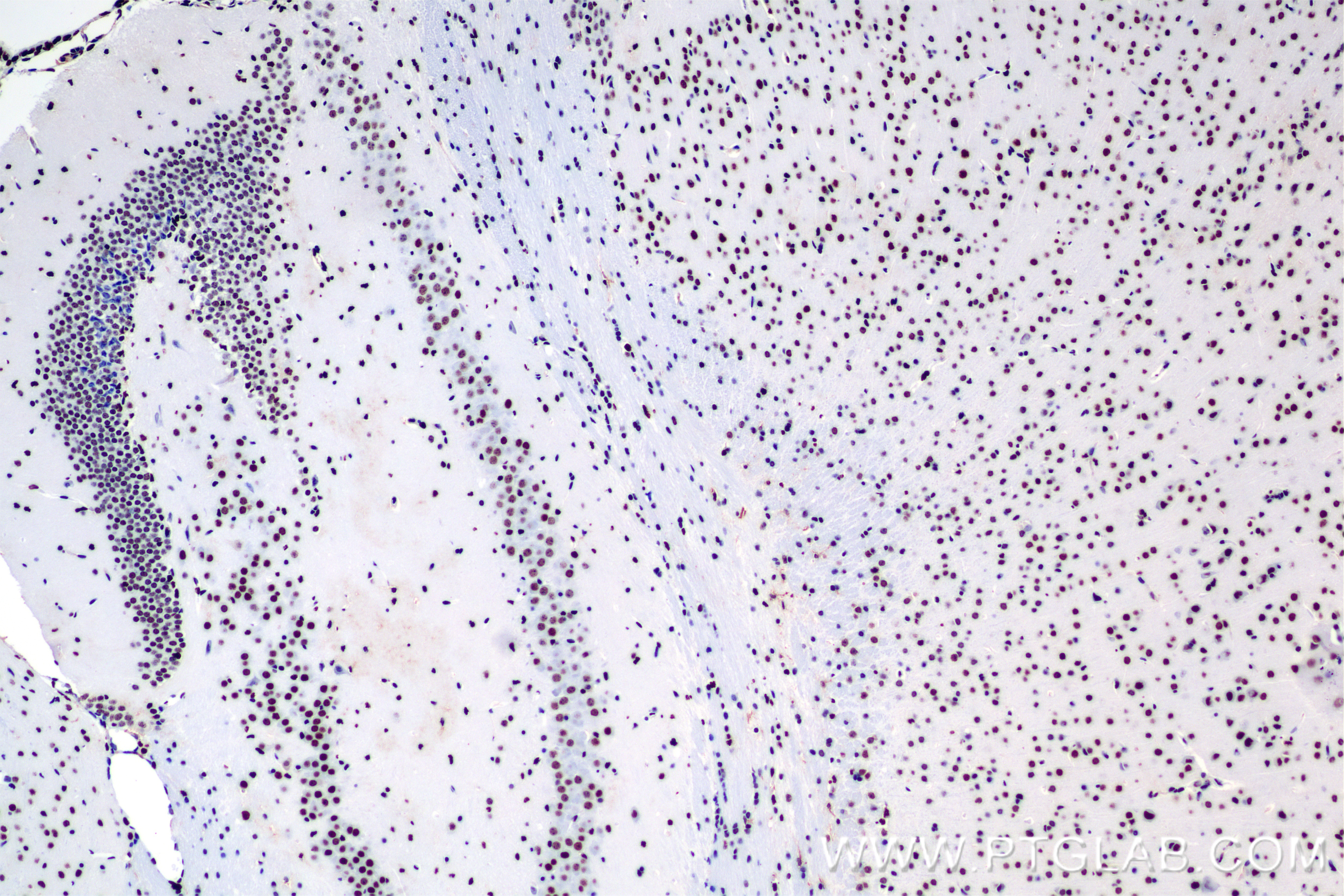 IHC staining of mouse brain using 84676-3-RR