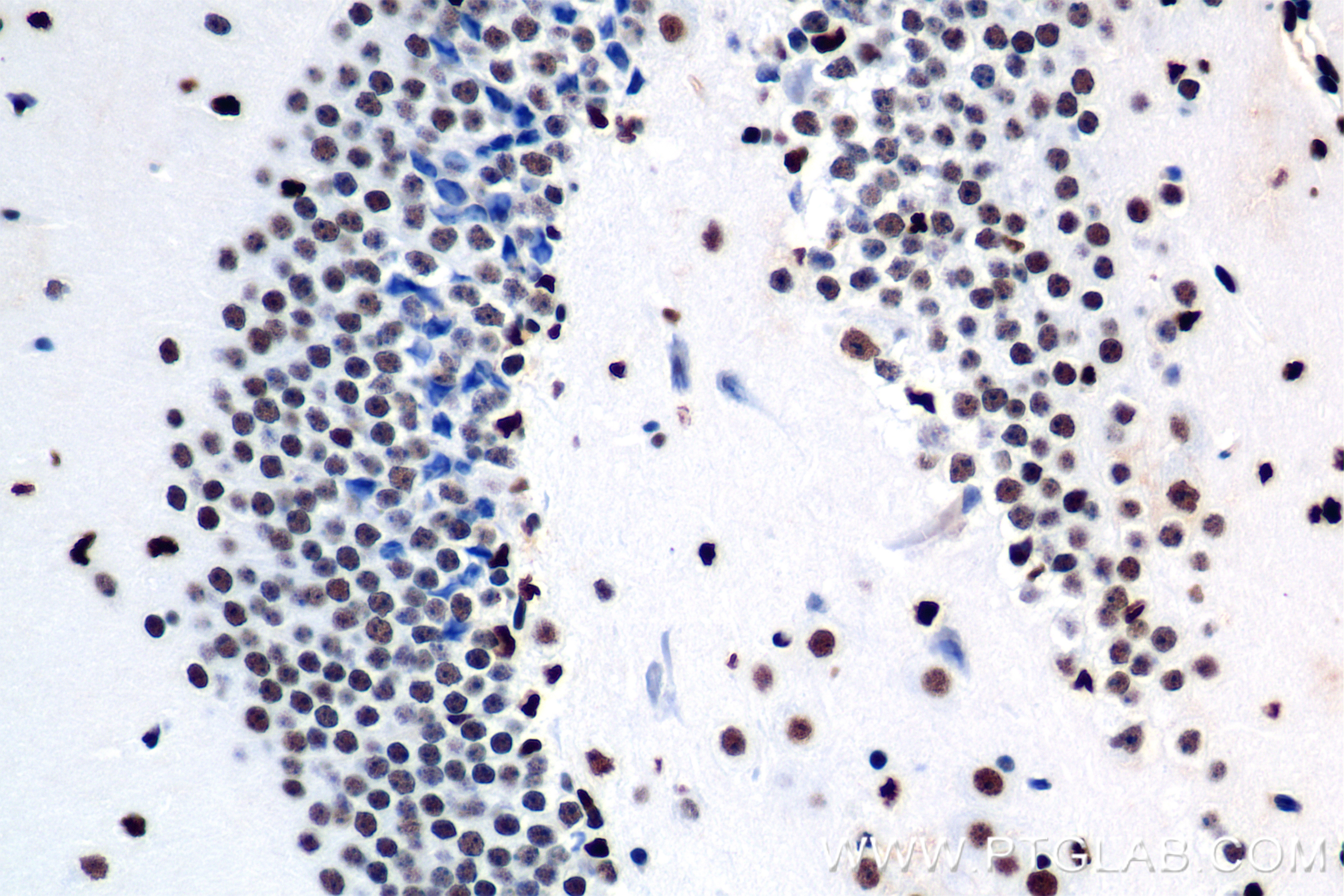 IHC staining of mouse brain using 84676-3-RR
