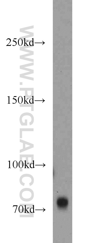 WB analysis of mouse brain using 11054-1-AP