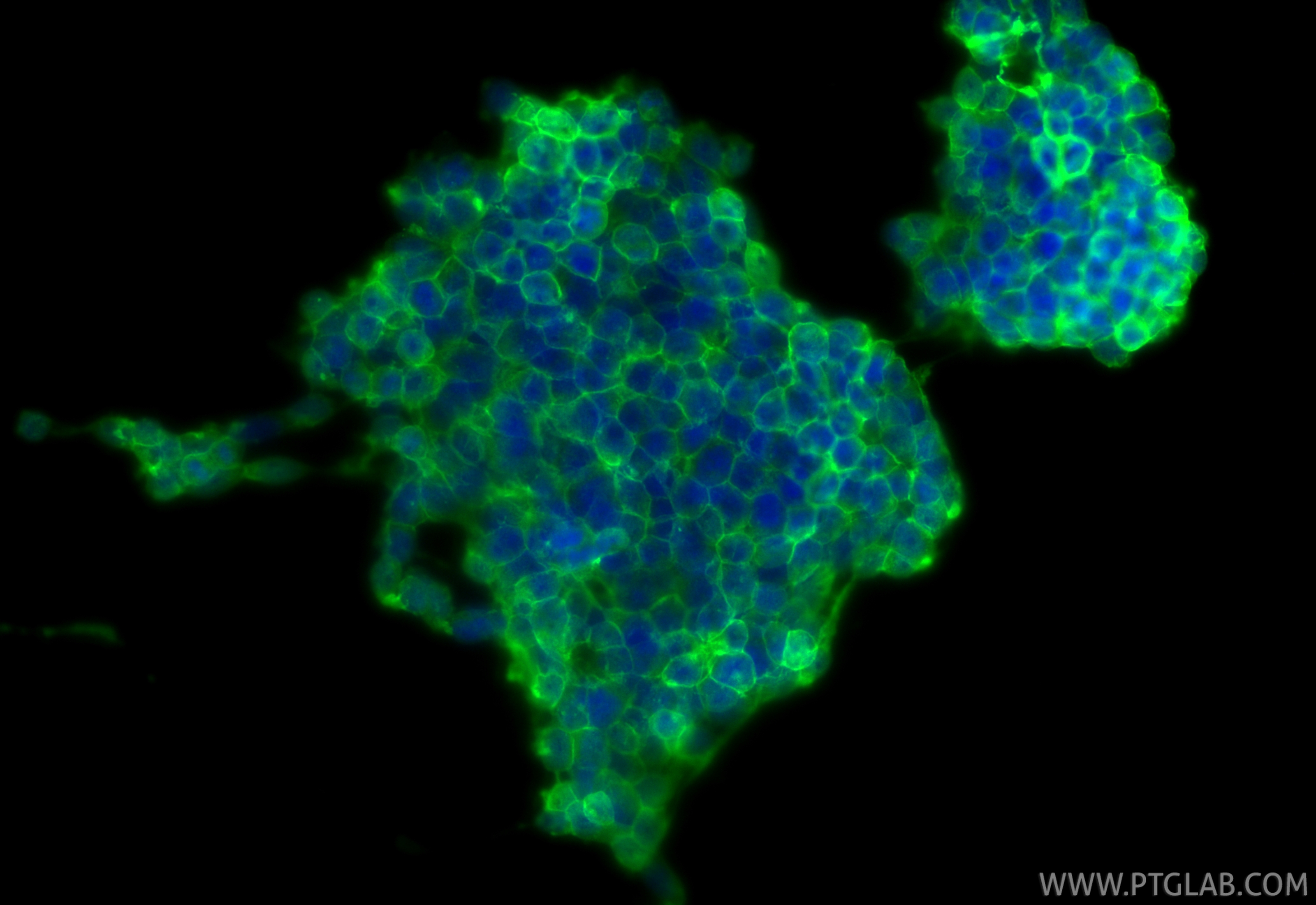 IF Staining of SH-SY5Y using 16971-1-AP
